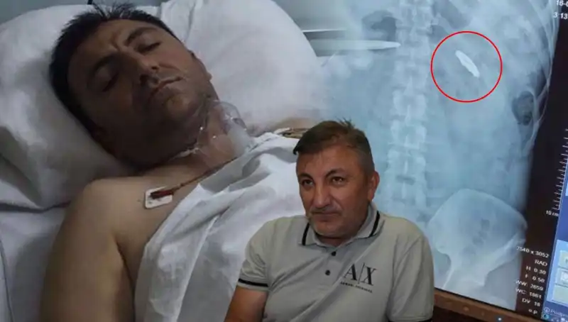 15 Temmuz'un Acı İzleri: Kurşunla Sarsılan Bir Hayatın Hikayesi