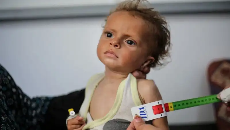 Gazzeli Çocuklar için İngiltere’nin Kapıları Açılıyor: 300 Çocuk Yeni Bir Umut Arıyor